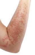Skin & Allergy